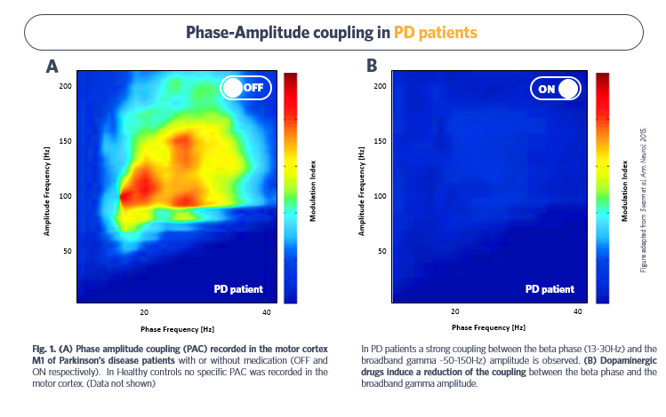 Diagram_SynapCell_Phase-Amplitude-Coupling-in-PD-patients